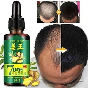 Ginger hair growth oil